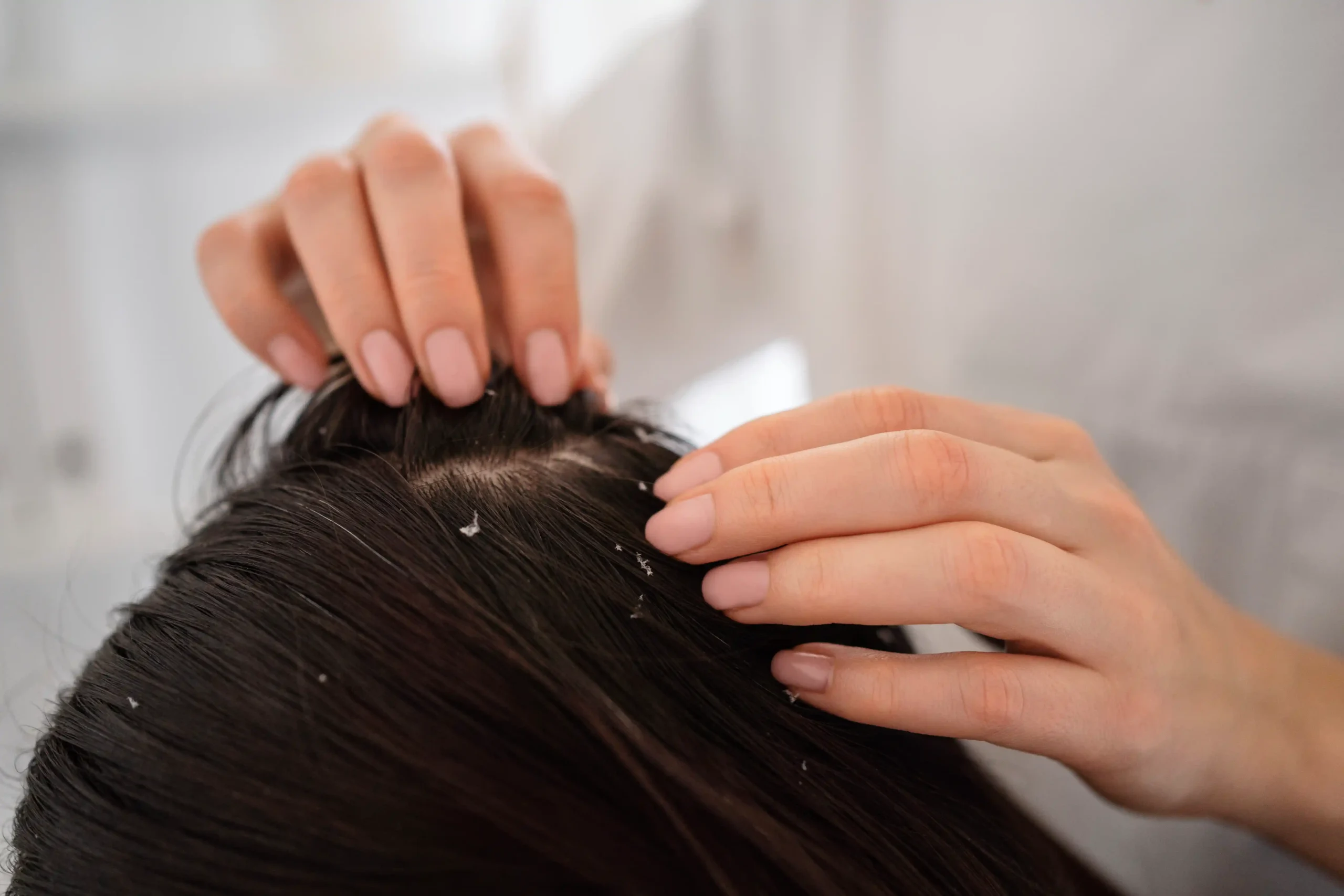 Pulihkan Rambut Kering Sekarang Anda dengan Hair Treatment Tonic Venon