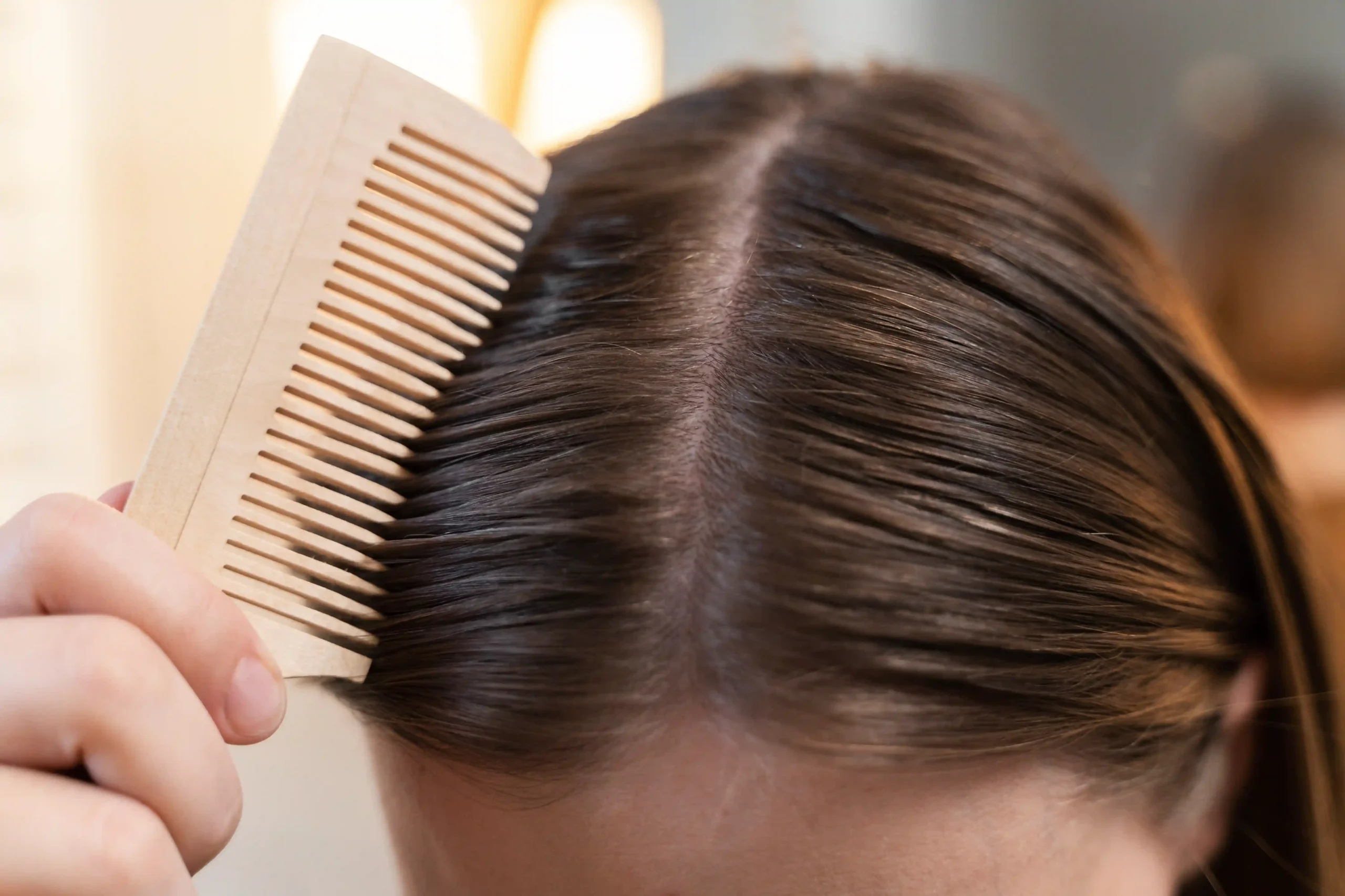 Penyebab Rambut Lepek Berminyak dan Solusinya